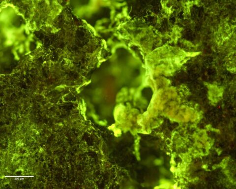 Makroaufnahme einer grünlich leuchtenden Gesteins- oder Erzprobe mit einer kleinen Maßstabsleiste.